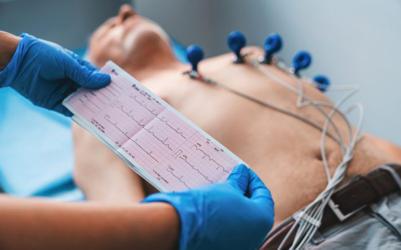 Electrocardiogram,,Ecg,In,Hand.,Cardiogram,Printout,On,Male,Patient,Background